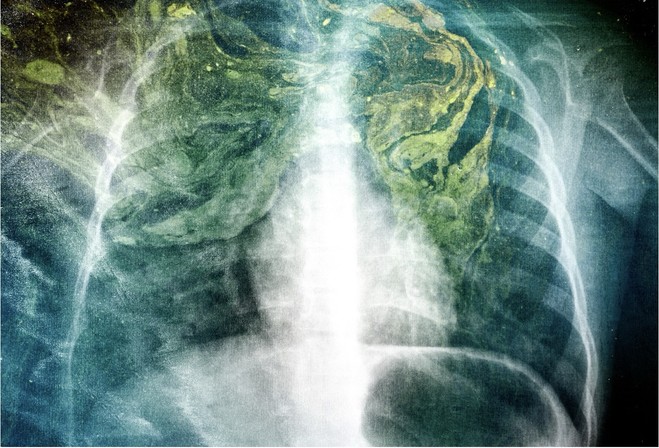 Jeanne Roualet, Verte Venise, 2023. Light box, édition spéciale